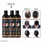 Cassidy_Ayurvedic_Controls_Hair_Fall_Premium_Onion_image_1.jpg