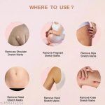 LABANGERRY_Top_Performed_stretch_mark_for_pregene_image_1.jpg