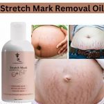 LA_BANGERRY_Stretch_Mark_oil__Bio-oil__stretch_mar_image_1.jpg