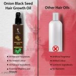 La_bangerry_Onion_Oil_Hair_Oil___100_ml__image_1.jpg