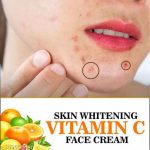 Evedics_Vitam-C_Whitning__Moisturizer_Fairness_Cr_image_1.jpg