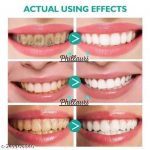 Phillauri_Teeth_Whitening_Foam_To_Removes_Bad_Brea_image_1.jpg